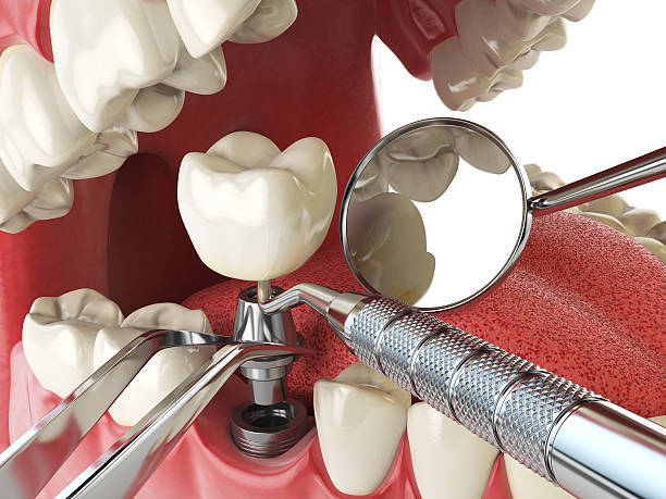 Dentist for Dental Trauma in AR